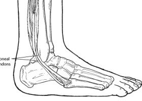 peroneal tendons and ankle pain
