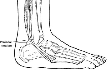 peroneal tendon pain tendonitis ankle foot injuries tendons injury tendinopathy bone where outer behind problems symptoms lateral ligament outside side